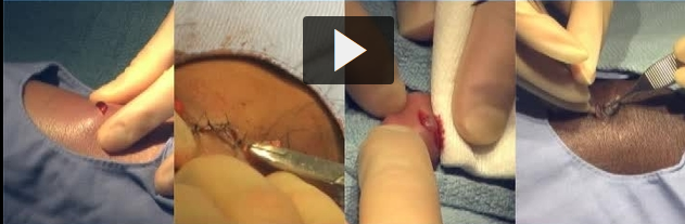 Healthy vs Infected Foot